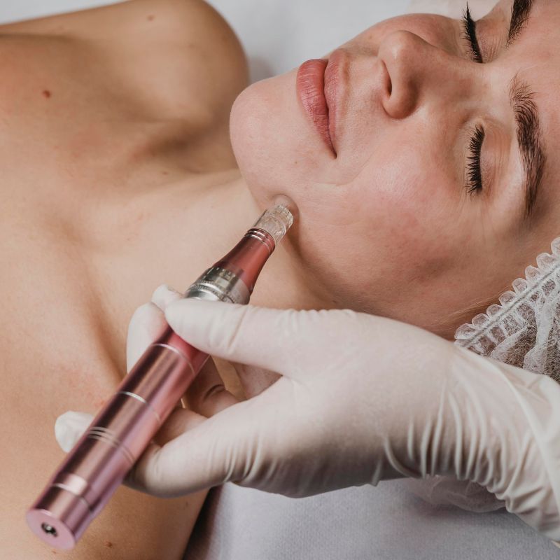 IMMORTAL DOUBLE SERUM TREATMENT with derma pen